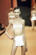 Anna-Carolina-Reston (died of anorexia)