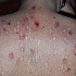 Агробактерии, как вектор системы передачи генов