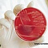 Французы подхватили E. Coli в Турции