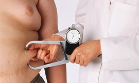 Ученые: От ожирения умирают чаще, чем от голода
