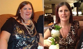 Женщина после гипноза потеряла 40 кг
