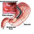 Некоторые заболевания органов пищеварения.