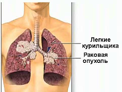 Витамин Е для профилактики рака