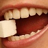 Ухудшение качества питания привело к "эпидемии" зубных заболеваний