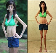 Лиззи Веласкес – самая худая женщина Америки