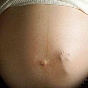 Питание при токсикозе беременных