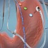 Электронный датчик в желудке спасет от ожирения