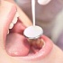 Чистые зубы помогают забеременеть