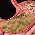 Переход химуса из желудка в кишечник.